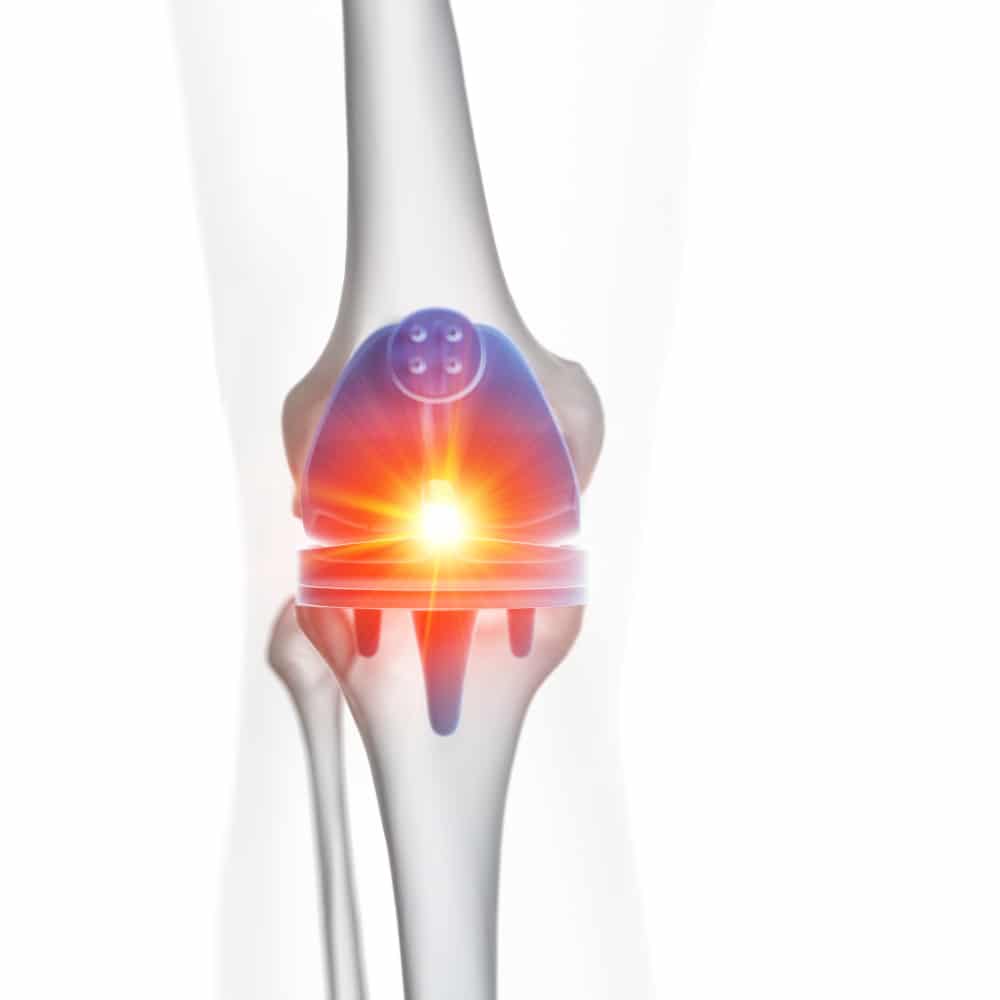 Harvard Trained Pain Doctors The Best Knee Treatments in Manhattan